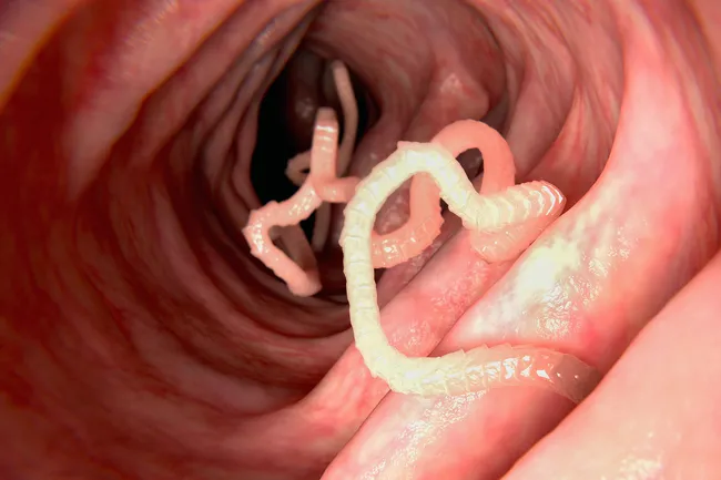 photo of tapeworm in intestine