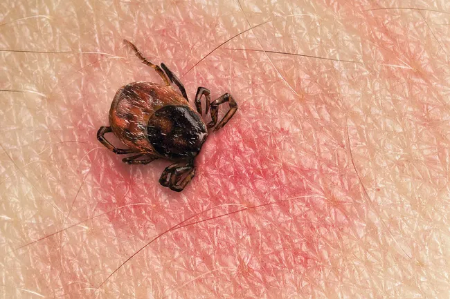 photo of tick burrowing into skin