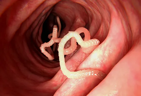 tapeworm illustration