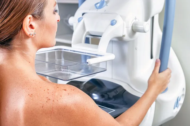 photo of mammogram