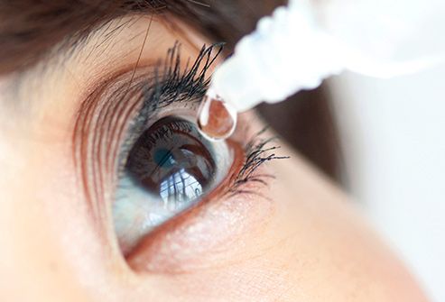 woman using eye drops close up