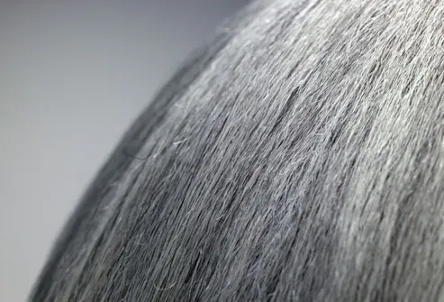getty rm photo of grey hair on womans head - مشکلات زیبایی:جواب به چند سوال خجالت آور در مورد زیبایی