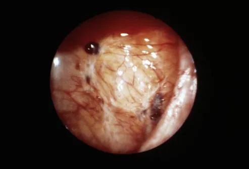 Endoscopic View Of Sex 73
