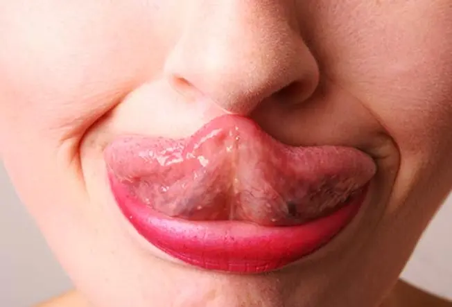 Tongue Lashing