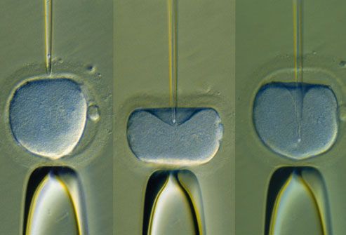 Injection of human sperm into egg