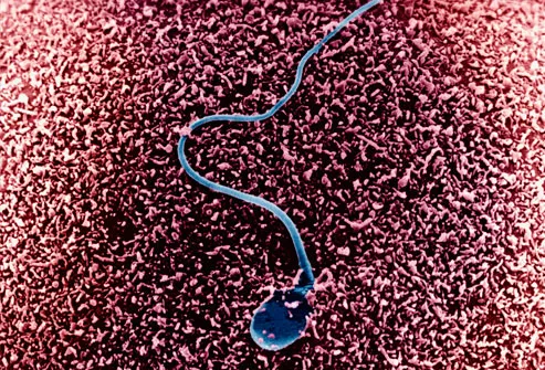 Human sperm on an egg surface. SEM.