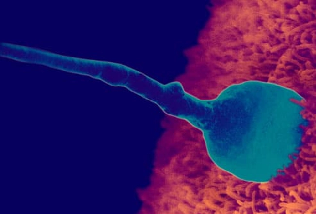Fertilization: Sperm Penetrates Egg