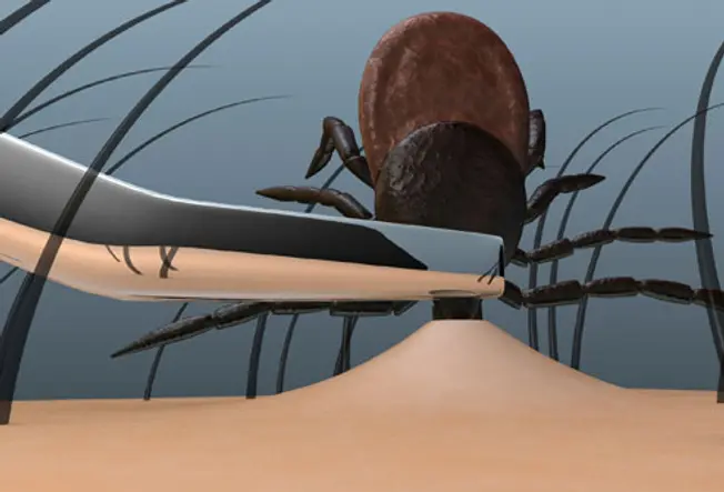 Safe Ways to Remove Ticks