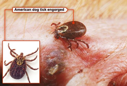 engorged american dog tick feeding on dogs ear
