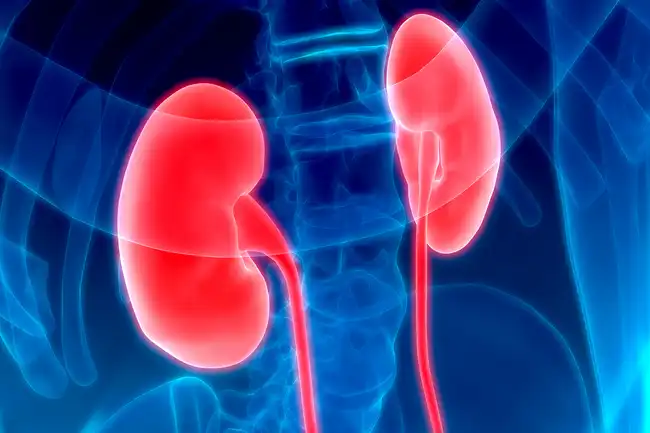kidney x-ray