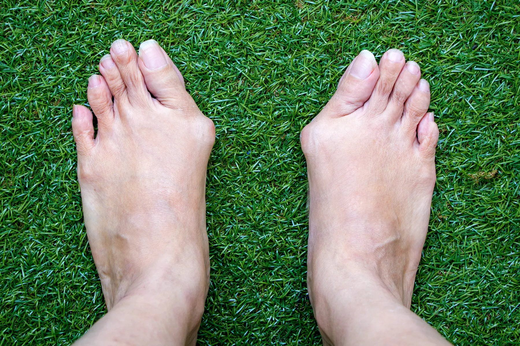Your Feet as You Age