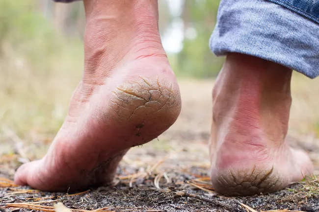 17 Things That Can Go Wrong With Your Feet As You Age