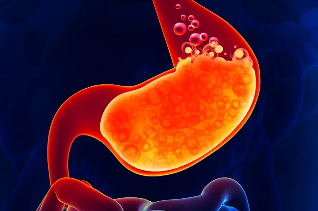 illustration of stomach acid