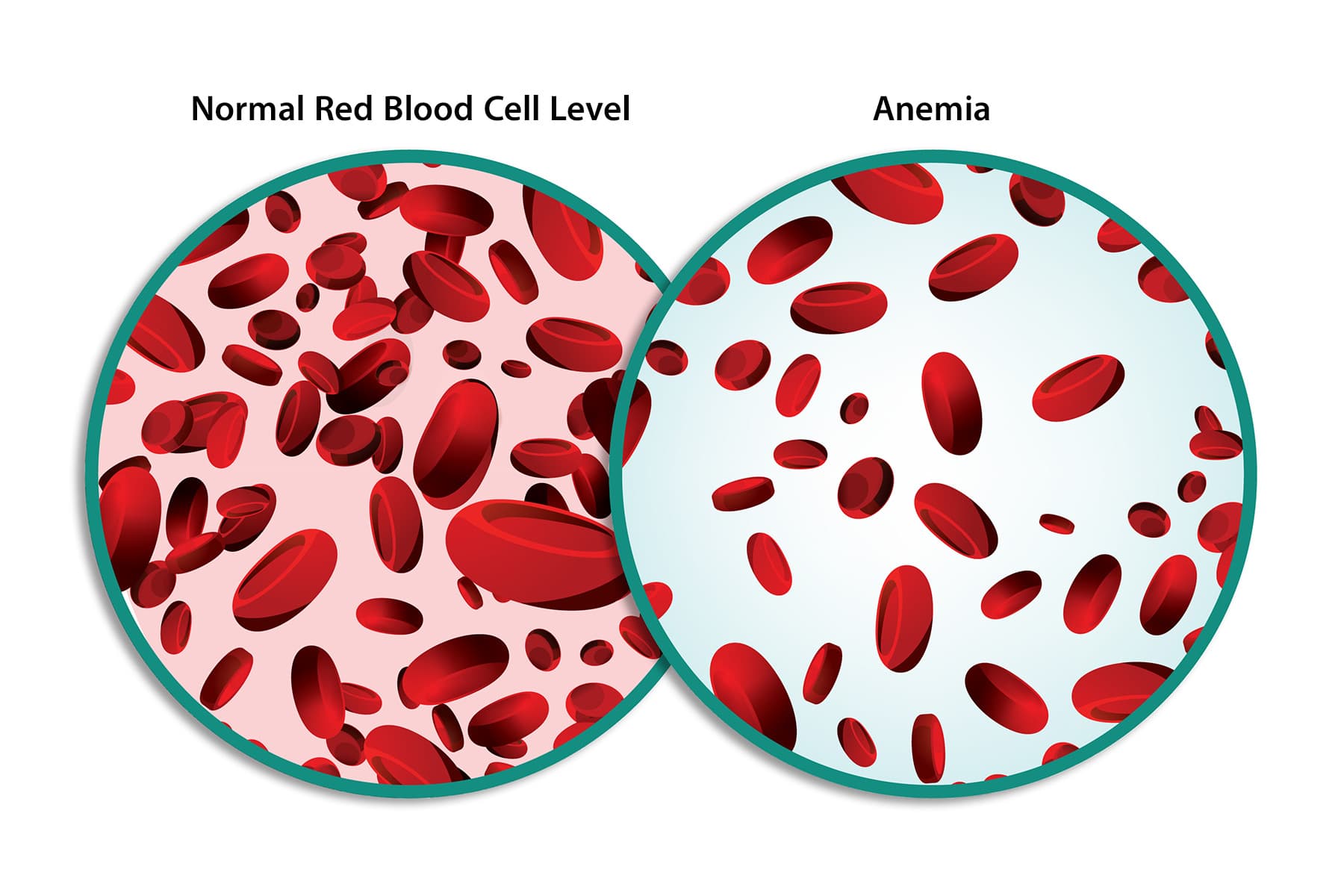 photo of normal blood vs anemia