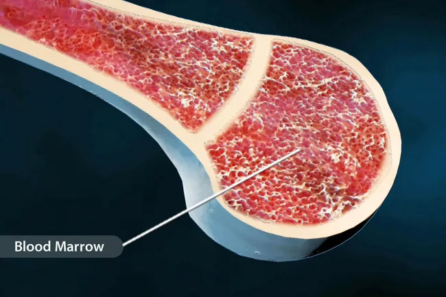 photo of bone marrow