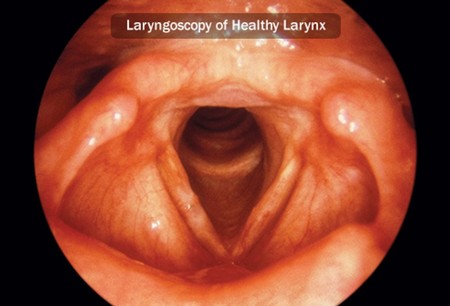 How Is Laryngeal Cancer Diagnosed?