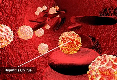 hepatitis virus in bloodstream