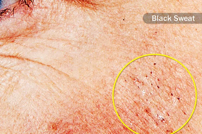 Pictures Of 15 Uncommon Skin Conditions
