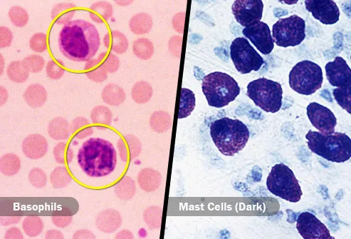 basophils mast cells diptych