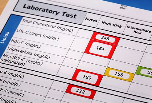 cholesterol test results