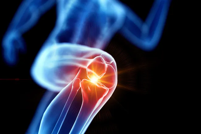 photo of inflamed knee joint