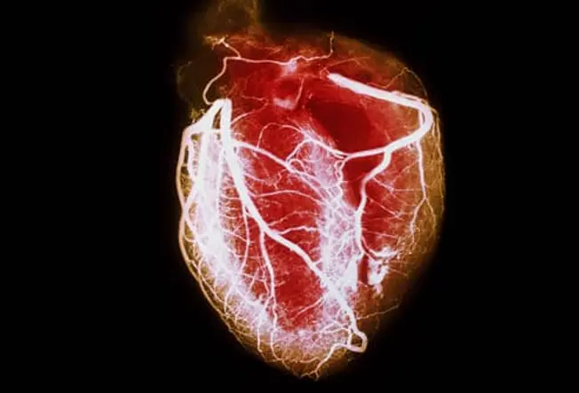 What's Heart Disease?