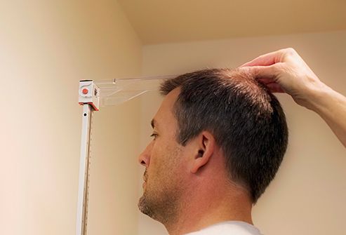 balding man being measured