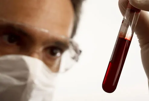 Doctor Analyzing Blood Sample