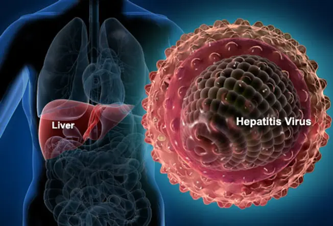 What Is Hepatitis?