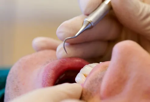 Dentist Treating Patient