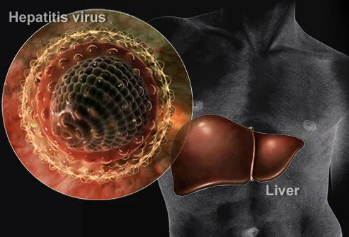 Composite of Hepatitis Virus and Liver