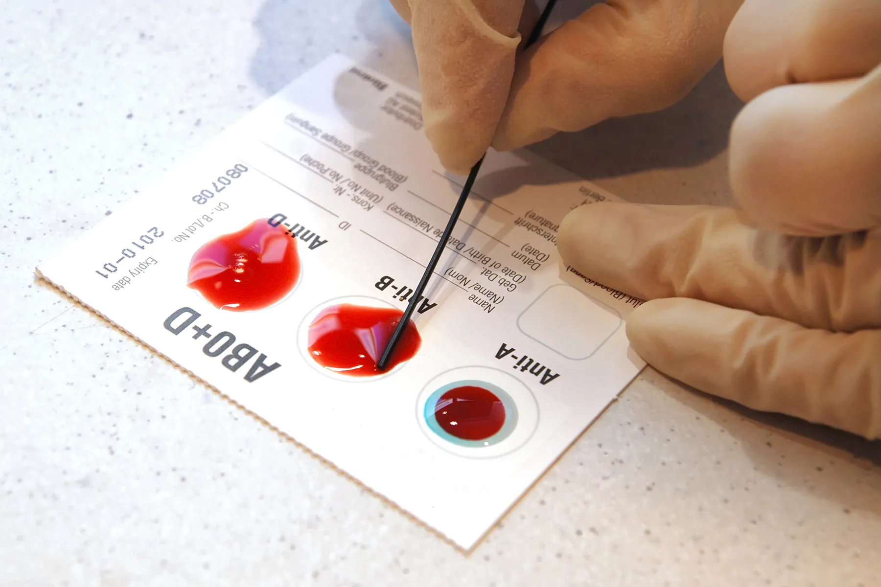photo of testing blood type