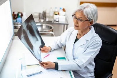 photo of doctor examining x-ray