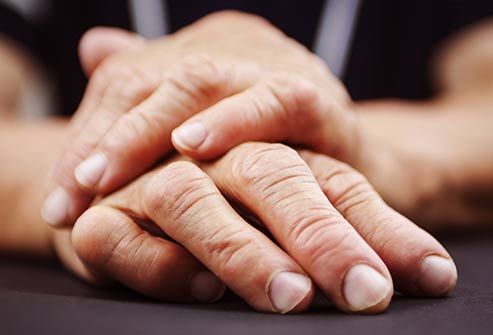 hands with rhuematoid arthritis