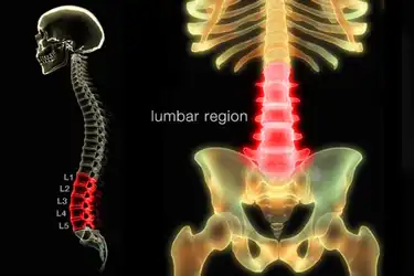 Low Back Pain Pictures Symptoms Causes Treatments