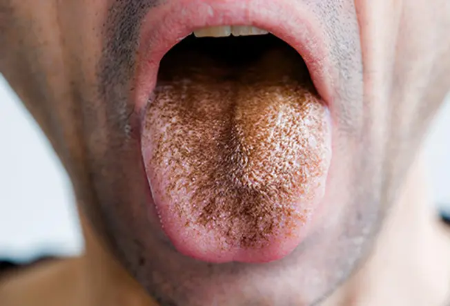 “Hair” on Your Tongue