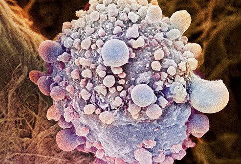 PRinc_rm_photo_of_pancreatic_cancer_cell.jpg