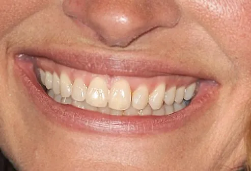 Julia Roberts's Smile