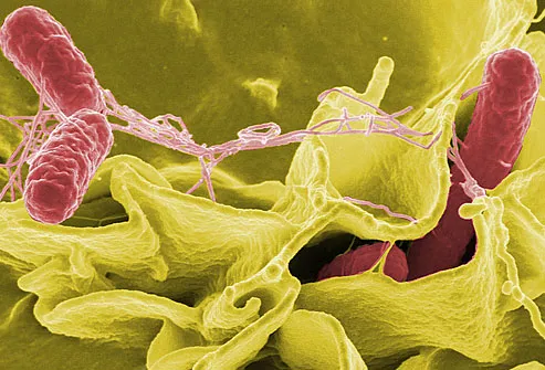 Salmonella invading cultured human cells