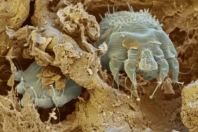 Scabies Mite Eggs Pictures