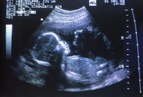 Image of ultrasound