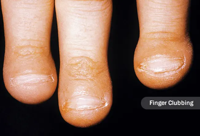 Fatter Fingertips