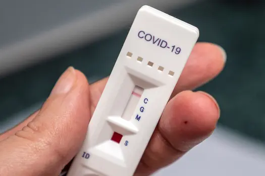 covid19 antibody test