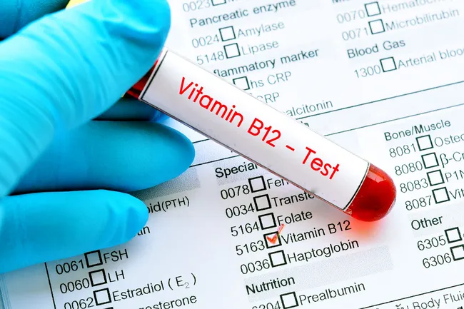 Pictures Signs Youre Low On Vitamin B12