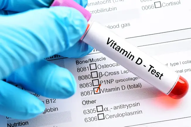Vitamin D: Why You Need It