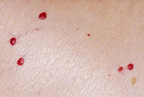 pinpoint red dots on skin pregnancy