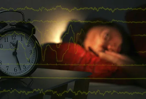 Disrupted Sleep Cycle - How Serious are Your Sleep Troubles?