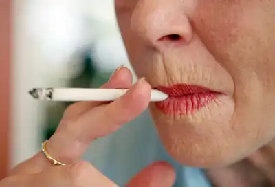 Woman With Wrinkled Lips From Smoking