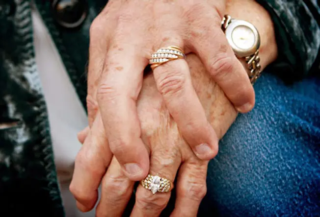 getty rf photo of hands swollen from arthritis