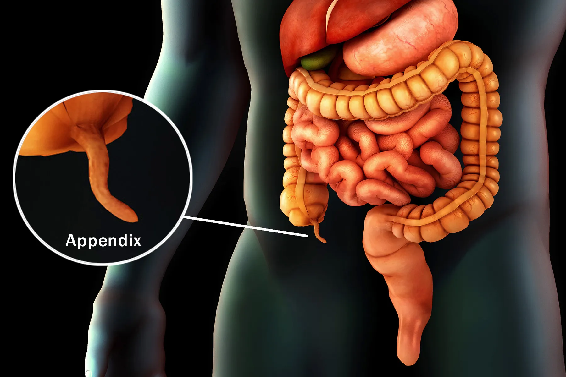 photo of appendix